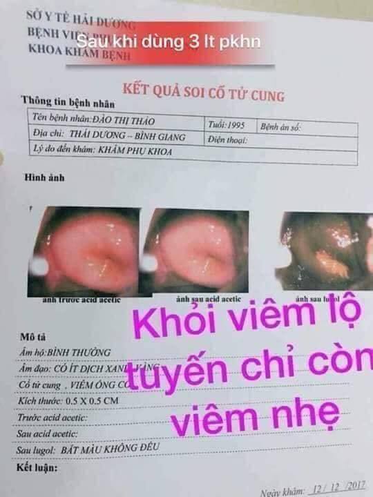 Phản hồi khách dùng thuốc phụ khoa họ Nguyễn