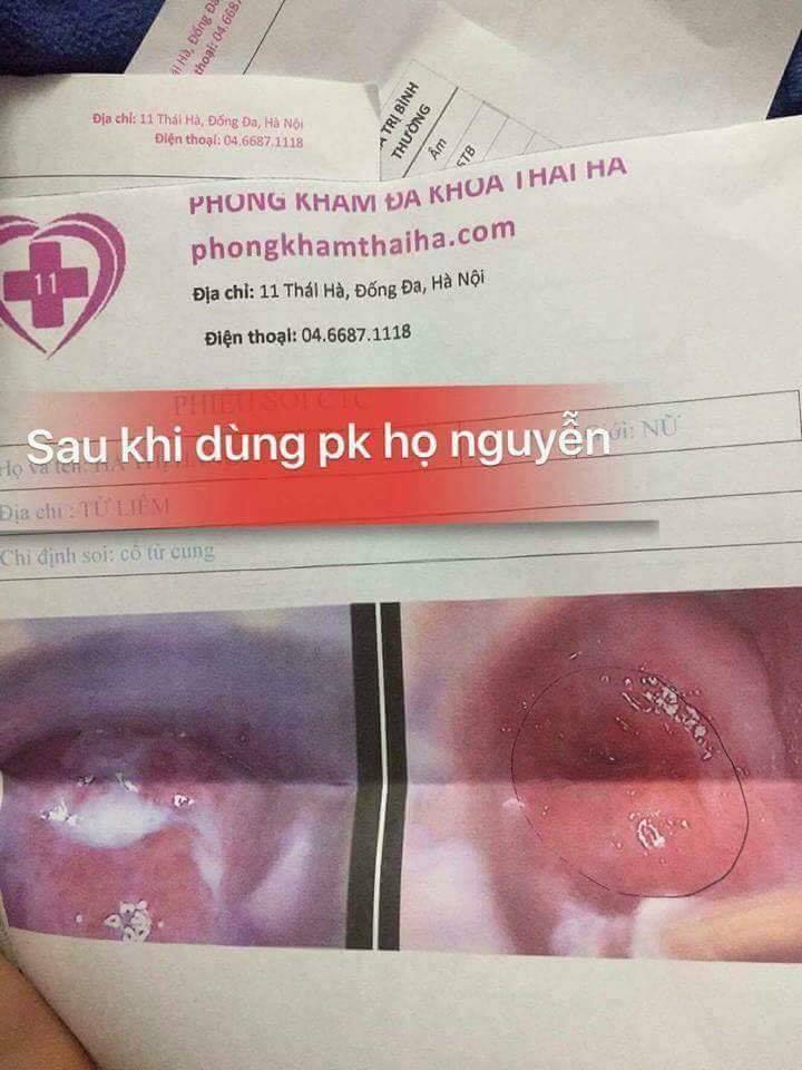 Phản hồi khách dùng thuốc phụ khang họ Nguyễn